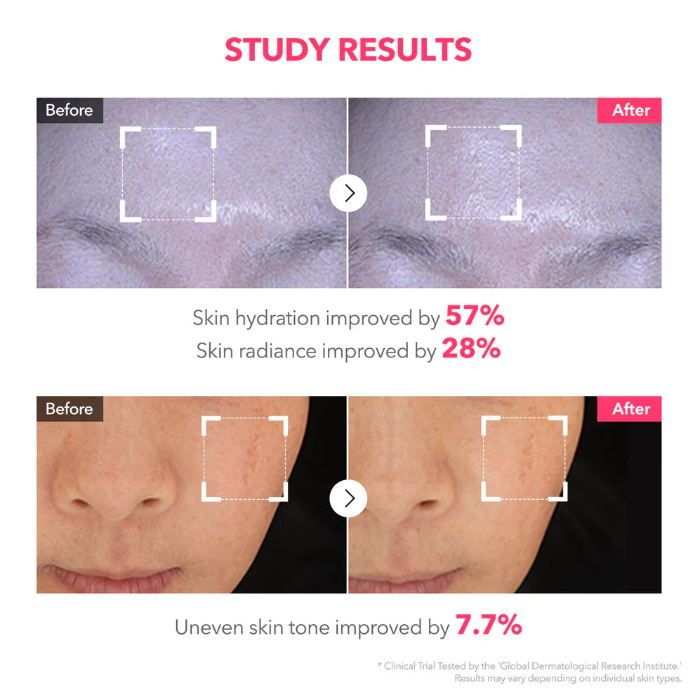 APRILSKIN TXA Pink Capsule Gel Mask